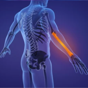 "Osteology" typically refers to the study of bones and skeletal tissues. Clinical research in osteology focuses on understanding various bone-related disorders, including osteoporosis, osteoarthritis, bone fractures, metabolic bone diseases, and bone cancers.